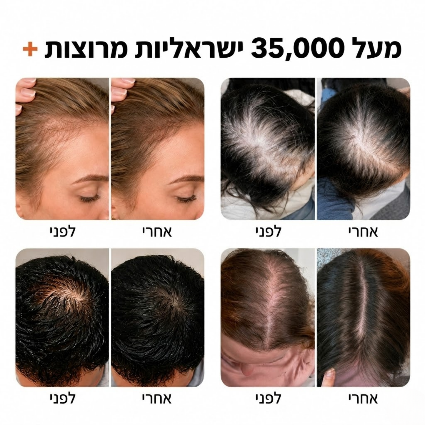 hairly
